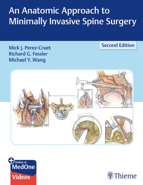 An Anatomic Approach to Minimally Invasive Spine Surgery, Multiple-component retail product, part(s) enclose Book