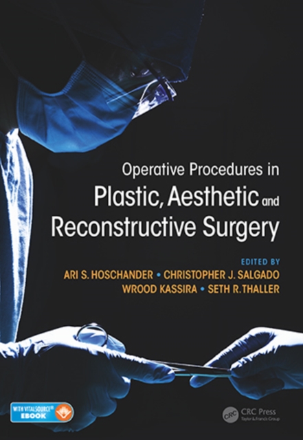 Operative Procedures in Plastic, Aesthetic and Reconstructive Surgery, Mixed media product Book