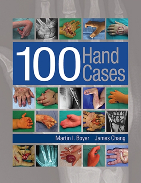 100 Hand Cases, Multiple-component retail product, part(s) enclose Book