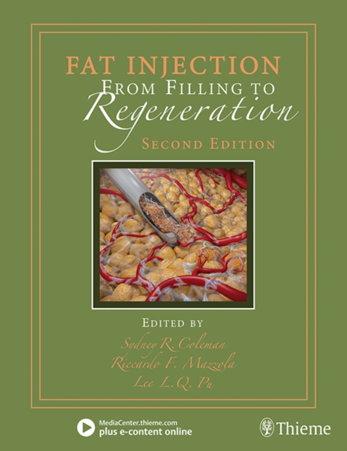 Fat Injection : From Filling to Regeneration, Mixed media product Book
