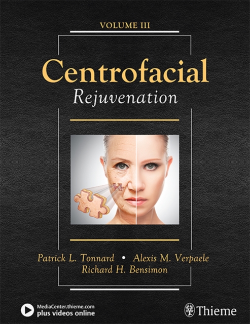 Centrofacial Rejuvenation, Multiple-component retail product, part(s) enclose Book
