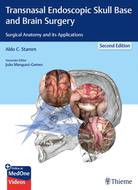 Transnasal Endoscopic Skull Base and Brain Surgery : Surgical Anatomy and its Applications, Multiple-component retail product, part(s) enclose Book