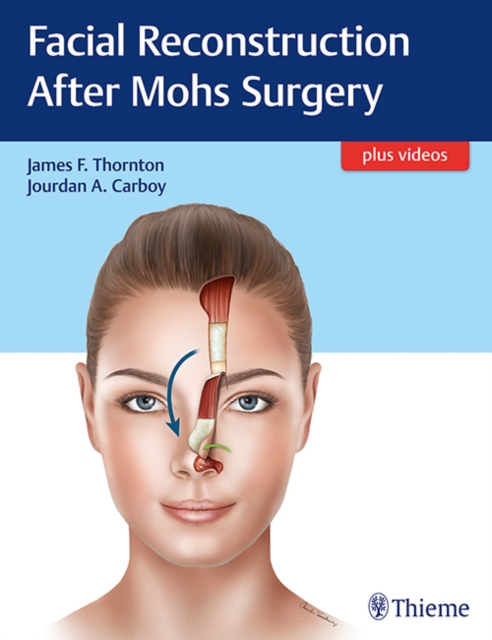 Facial Reconstruction After Mohs Surgery, Mixed media product Book