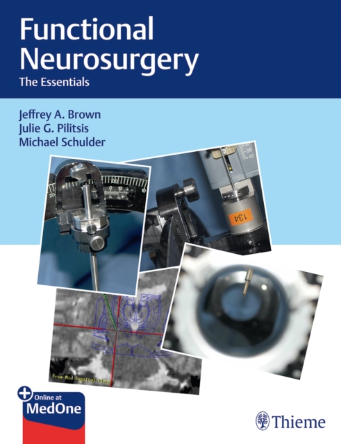 Functional Neurosurgery : The Essentials, Hardback Book