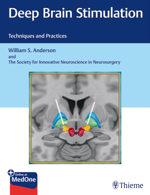 Deep Brain Stimulation : Techniques and Practices, Hardback Book