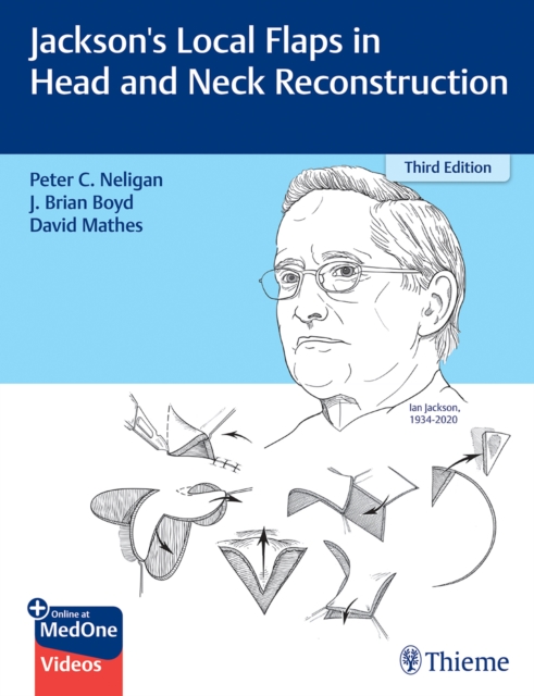 Jackson's Local Flaps in Head and Neck Reconstruction, Multiple-component retail product, part(s) enclose Book
