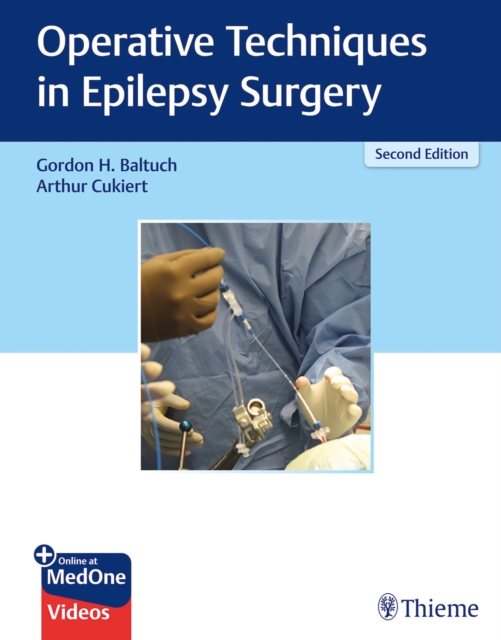 Operative Techniques in Epilepsy Surgery, Multiple-component retail product, part(s) enclose Book