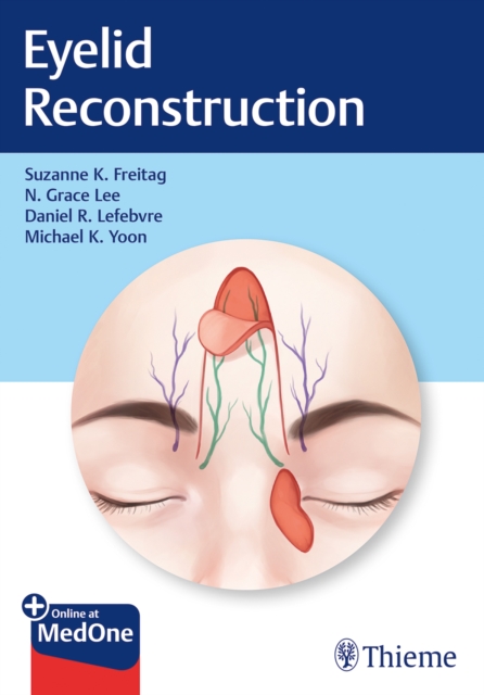 Eyelid Reconstruction, Multiple-component retail product, part(s) enclose Book