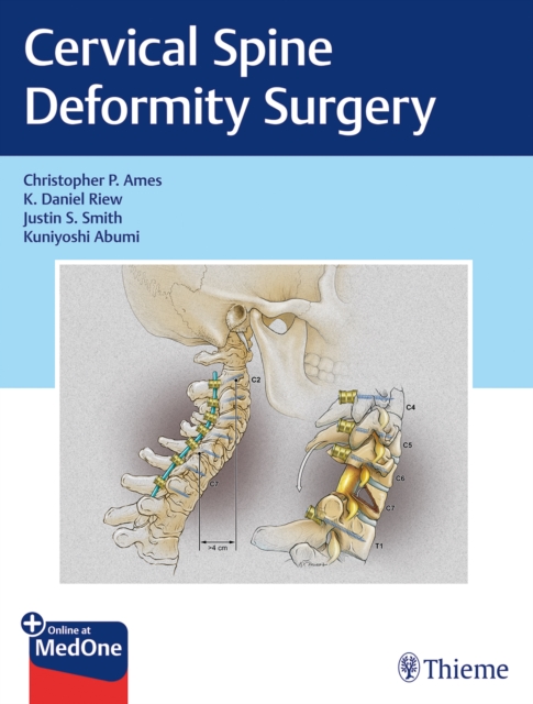 Cervical Spine Deformity Surgery, Mixed media product Book