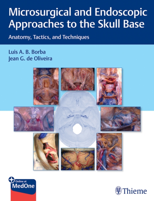 Microsurgical and Endoscopic Approaches to the Skull Base : Anatomy, Tactics, and Techniques, Mixed media product Book