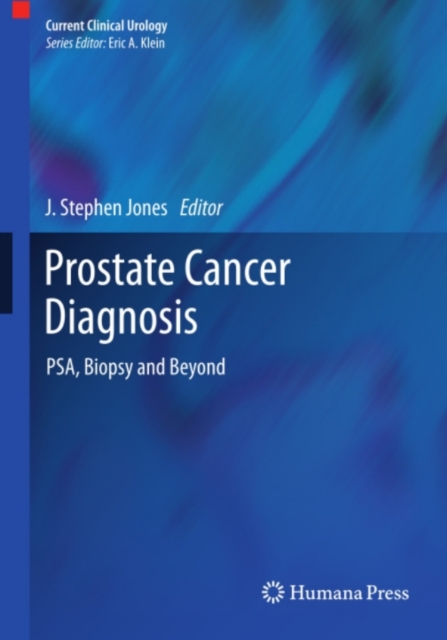 Prostate Cancer Diagnosis : PSA, Biopsy and Beyond, PDF eBook