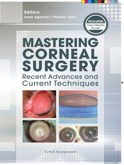 Mastering Corneal Surgery : Recent Advances and Current Techniques, EPUB eBook