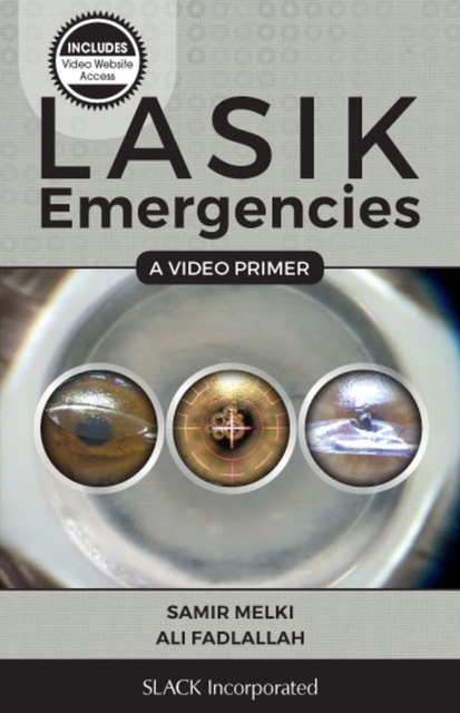 LASIK Emergencies : A Video Primer, Paperback / softback Book