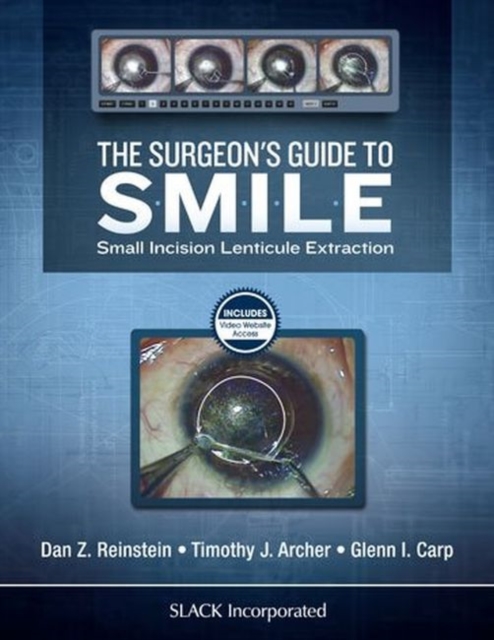 The Surgeon’s Guide to SMILE : Small Incision Lenticule Extraction, Hardback Book