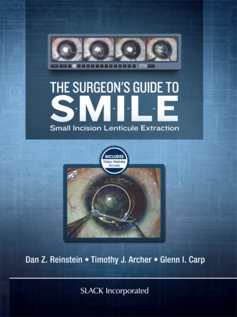 The Surgeon's Guide to SMILE : Small Incision Lenticule Extraction, EPUB eBook