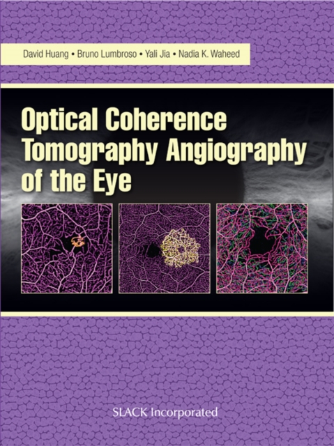 Optical Coherence Tomography Angiography of the Eye, EPUB eBook