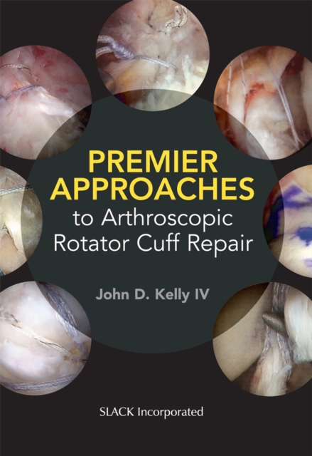 Premier Approaches to Arthroscopic Rotator Cuff Repair, Paperback / softback Book