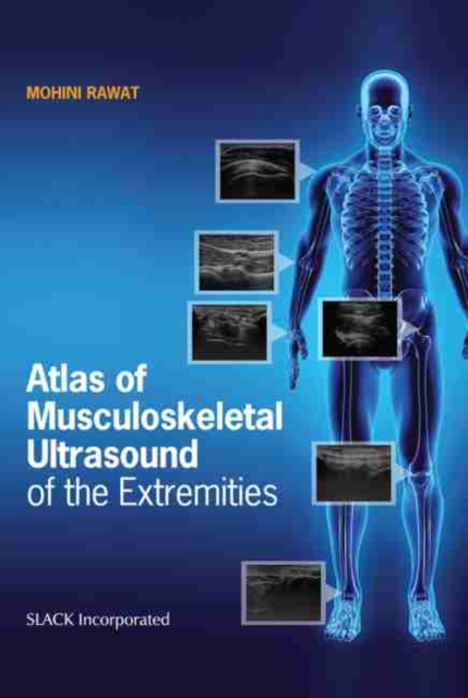 Atlas of Musculoskeletal Ultrasound of the Extremities, Paperback / softback Book