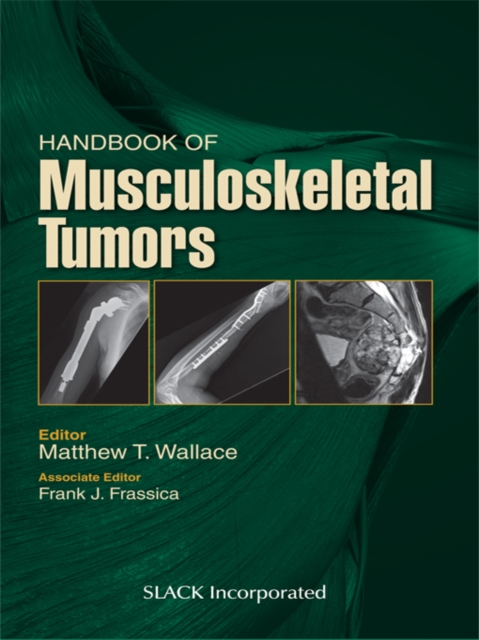 Handbook of Musculoskeletal Tumors, EPUB eBook