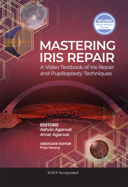 Mastering Iris Repair : A Video Textbook of Iris Repair and Pupilloplasty Techniques, Paperback / softback Book