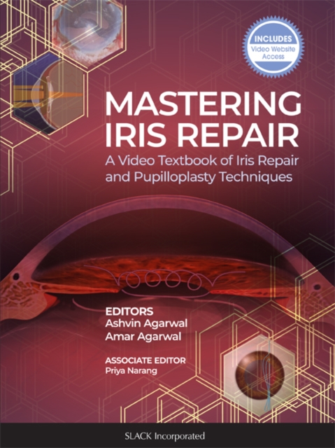 Mastering Iris Repair : A Video Textbook of Iris Repair and Pupilloplasty Techniques, EPUB eBook