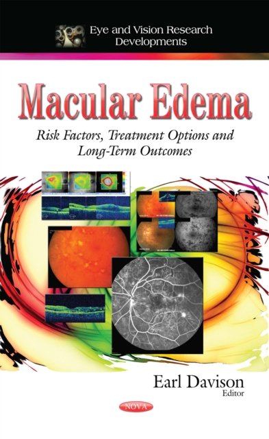 Macular Edema : Risk Factors, Treatment Options and Long-Term Outcomes, PDF eBook