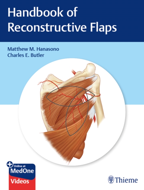 Handbook of Reconstructive Flaps, EPUB eBook