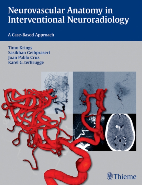 Neurovascular Anatomy in Interventional Neuroradiology : A Case-Based Approach, EPUB eBook