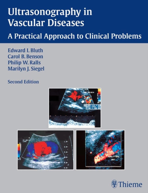 Ultrasonography in Vascular Diseases : A Practical Approach to Clinical Problems, EPUB eBook