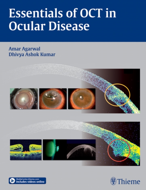 Essentials of OCT in Ocular Disease, EPUB eBook