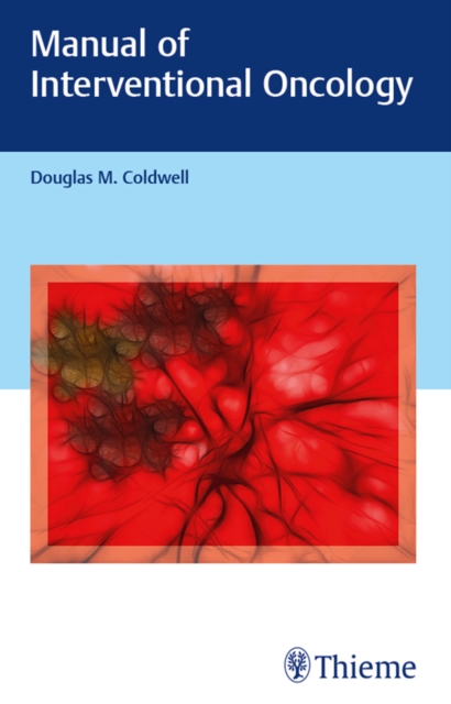 Manual of Interventional Oncology, EPUB eBook