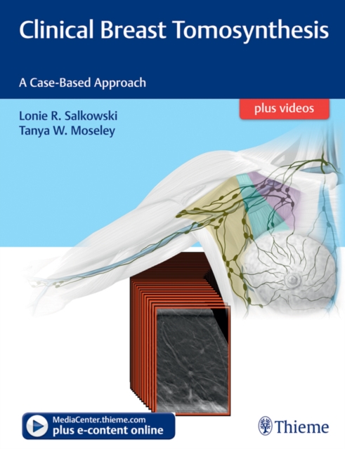 Clinical Breast Tomosynthesis : A Case-Based Approach, EPUB eBook