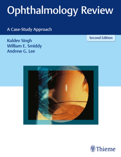 Ophthalmology Review : A Case-Study Approach, EPUB eBook