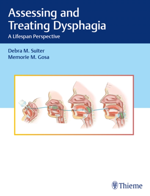 Assessing and Treating Dysphagia : A Lifespan Perspective, EPUB eBook