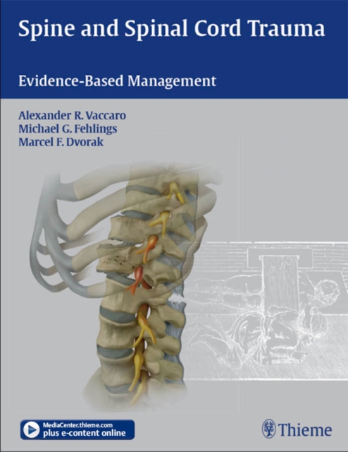 Spine and Spinal Cord Trauma : Evidence-Based Management, EPUB eBook