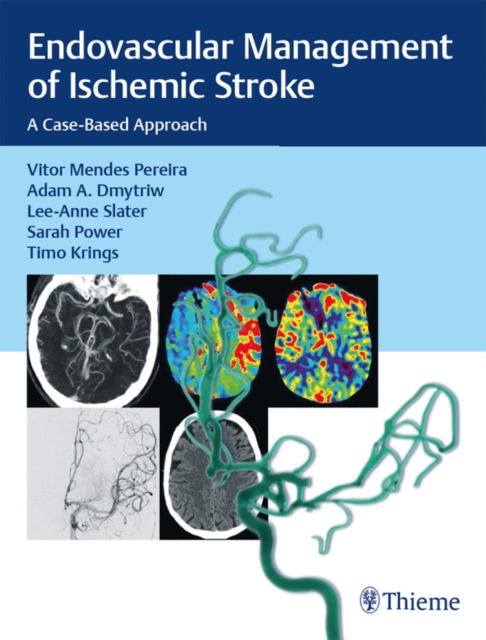 Endovascular Management of Ischemic Stroke : A Case-Based Approach, EPUB eBook