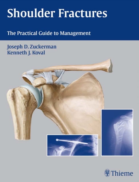 Shoulder Fractures : The Practical Guide to Management, EPUB eBook