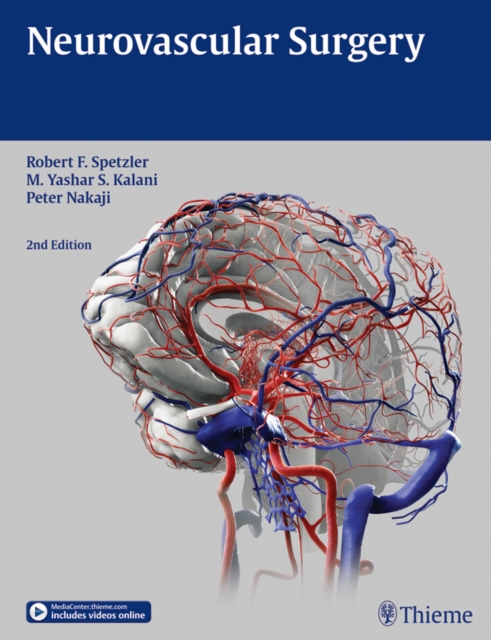 Neurovascular Surgery, EPUB eBook