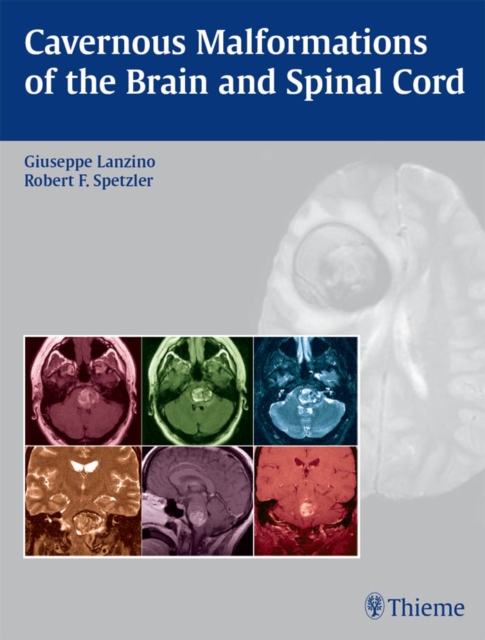 Cavernous Malformations of the Brain and Spinal Cord, EPUB eBook