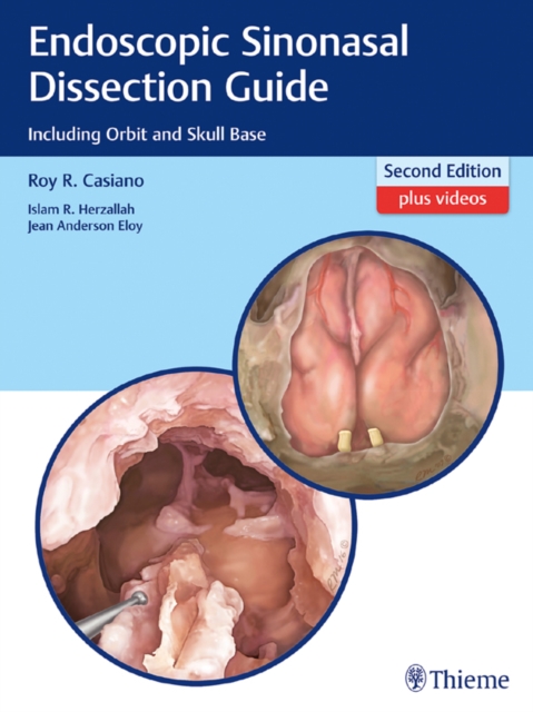 Endoscopic Sinonasal Dissection Guide : Including Orbit and Skull Base, EPUB eBook