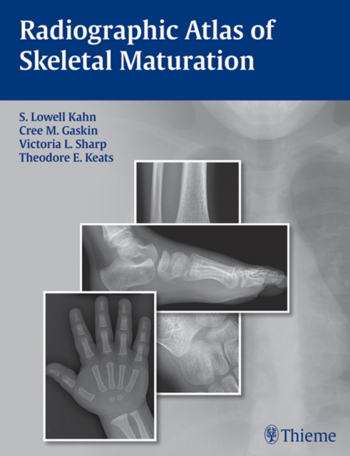 Radiographic Atlas of Skeletal Maturation, EPUB eBook