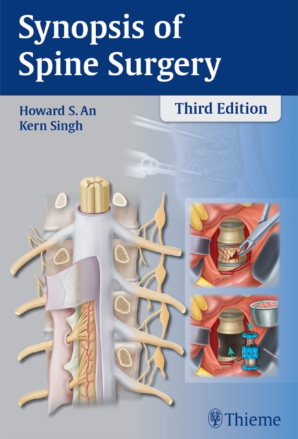Synopsis of Spine Surgery, EPUB eBook