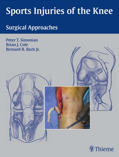 Sports Injuries of the Knee : Surgical Approaches, EPUB eBook
