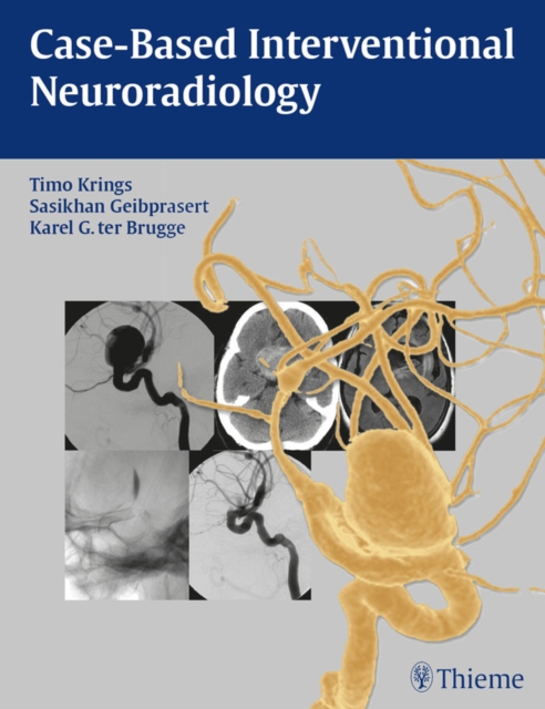 Case-Based Interventional Neuroradiology, EPUB eBook