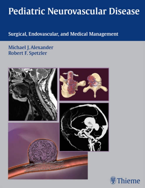 Pediatric Neurovascular Disease : Surgical, Endovascular, and Medical Management, EPUB eBook