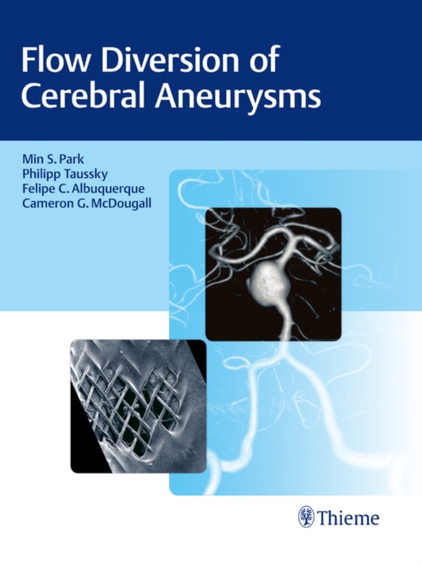 Flow Diversion of Cerebral Aneurysms, EPUB eBook