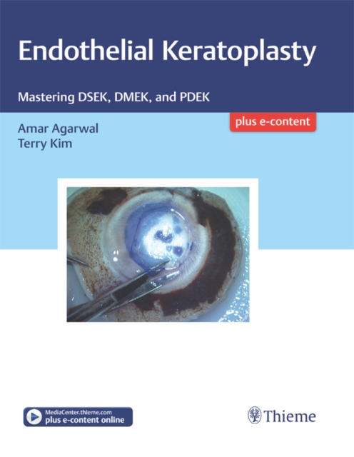 Endothelial Keratoplasty : Mastering DSEK, DMEK, and PDEK, EPUB eBook