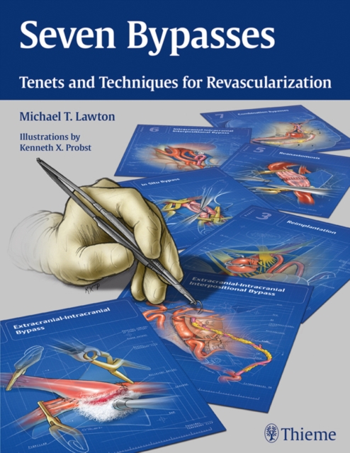 Seven Bypasses : Tenets and Techniques for Revascularization, EPUB eBook