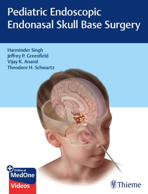 Pediatric Endoscopic Endonasal Skull Base Surgery, EPUB eBook
