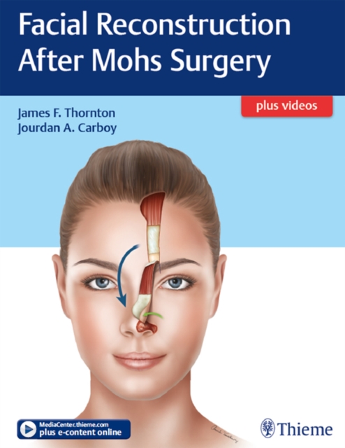 Facial Reconstruction After Mohs Surgery, EPUB eBook